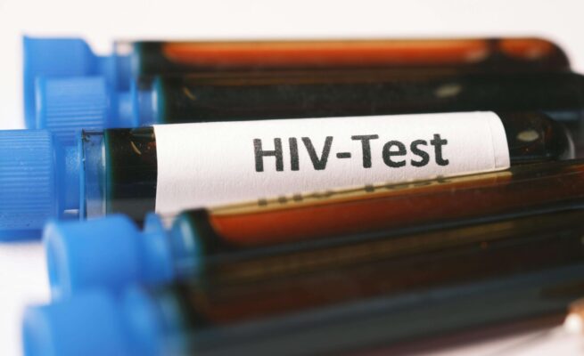 Kasus HIV/AIDS di Aceh Tembus 1.974, Anak Muda Kini Jadi Penyumbang Terbesar